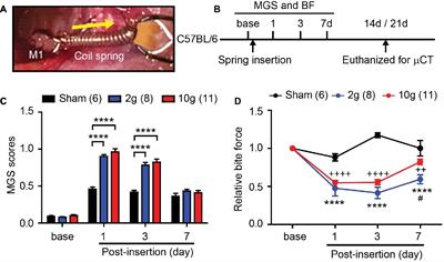 TRPV1 and TRPV1-Expressing Nociceptors Mediate Orofacial Pain Behaviors in a Mouse Model of Orthodontic Tooth Movement